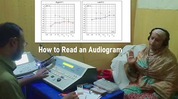 Pure Tone Audiometry: How it is Done. How to Interpret a Pure Tone Audiogram