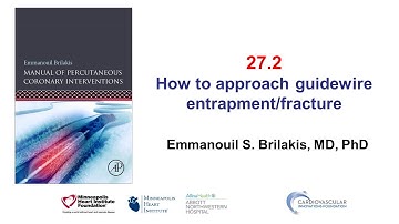 27.2 Guidewire entrapment and fracture - Manual of PCI