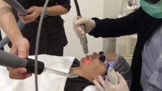 Fotona 4D Laser Skin Tightening Non-Surgical Facelift & Skin Tightening