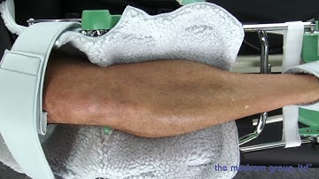 Spectra Knee CPM Setup