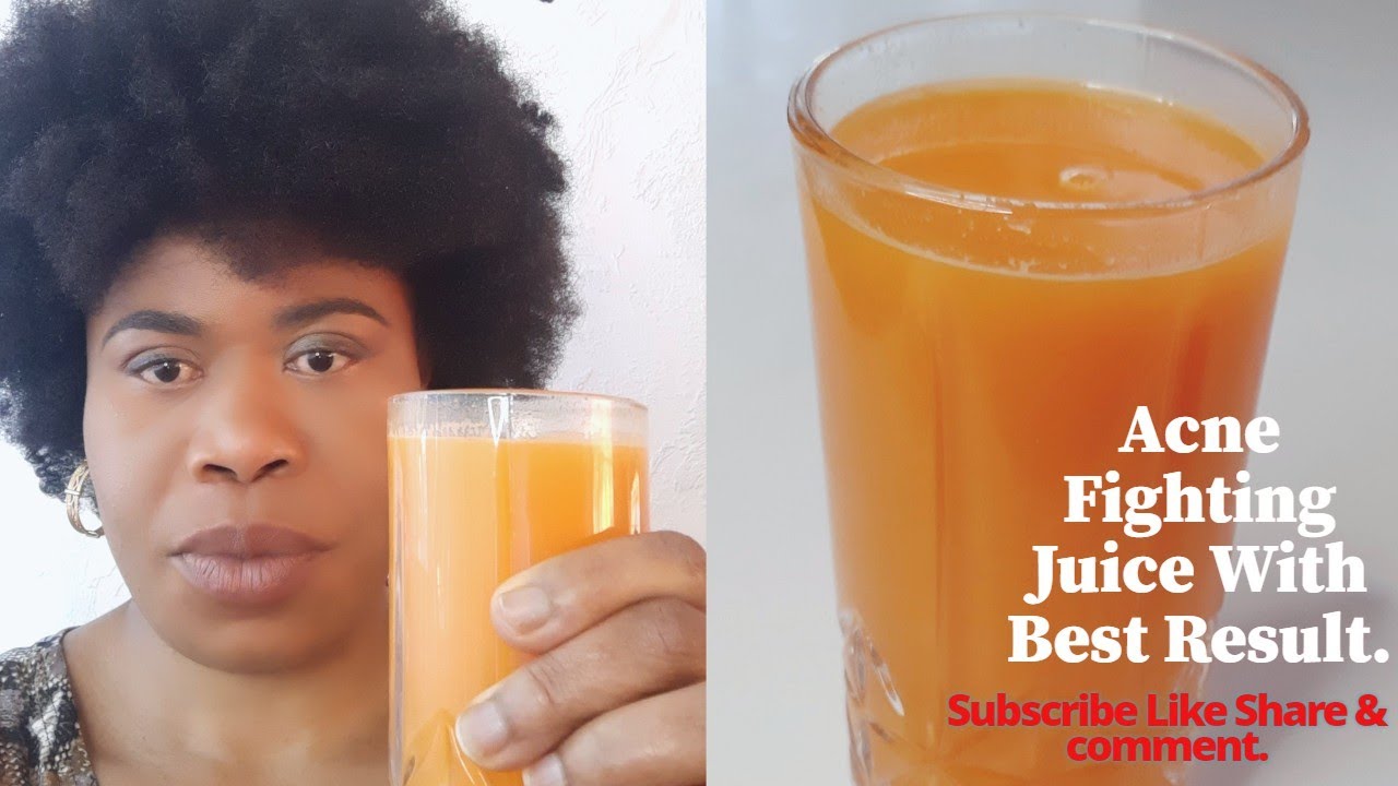 HOW I CLEAR MY ACNE IN 7 DAYS WITH THIS POWERFUL DRINK. - YouTube