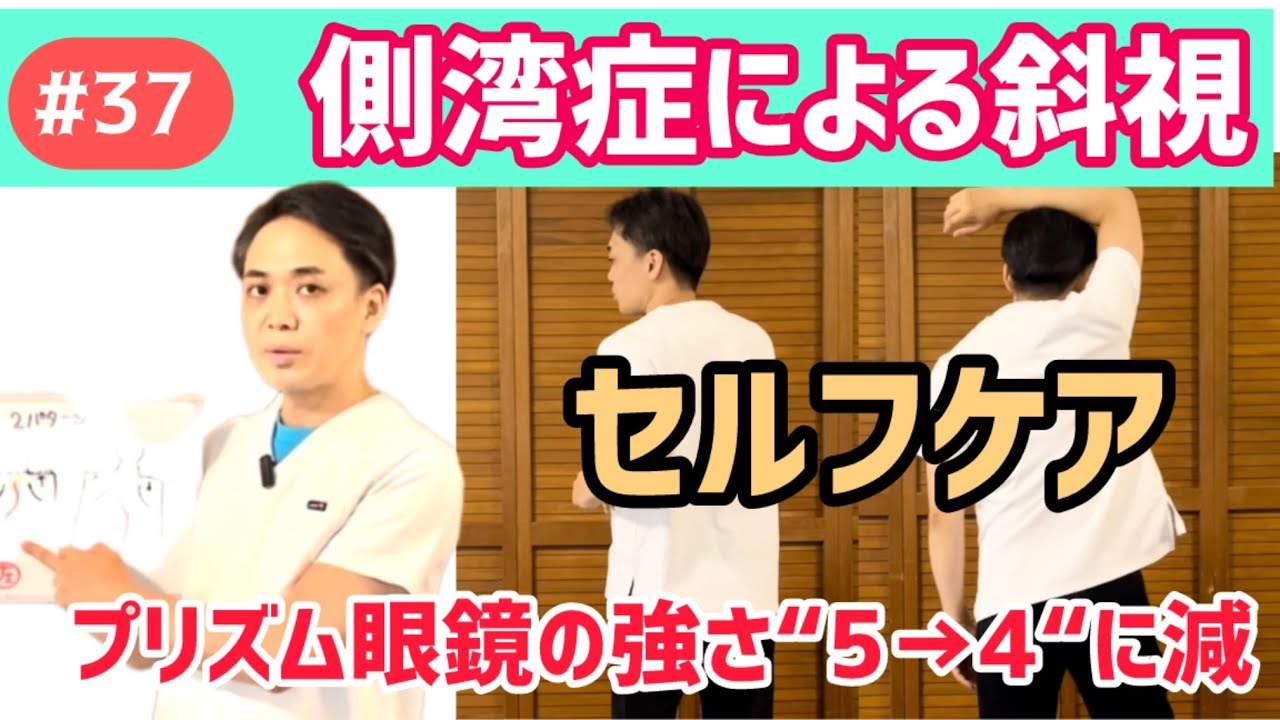 肉眼病理 Vol. 37 症例集 No. 37) Improved strabismus caused by scoliosis, which is