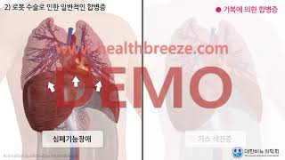 [시연용] c0289aako_[대한비뇨의학회] 로봇보조 복강경 근치적 방광절제술 및 신방광조성술 안내 [동의서용]