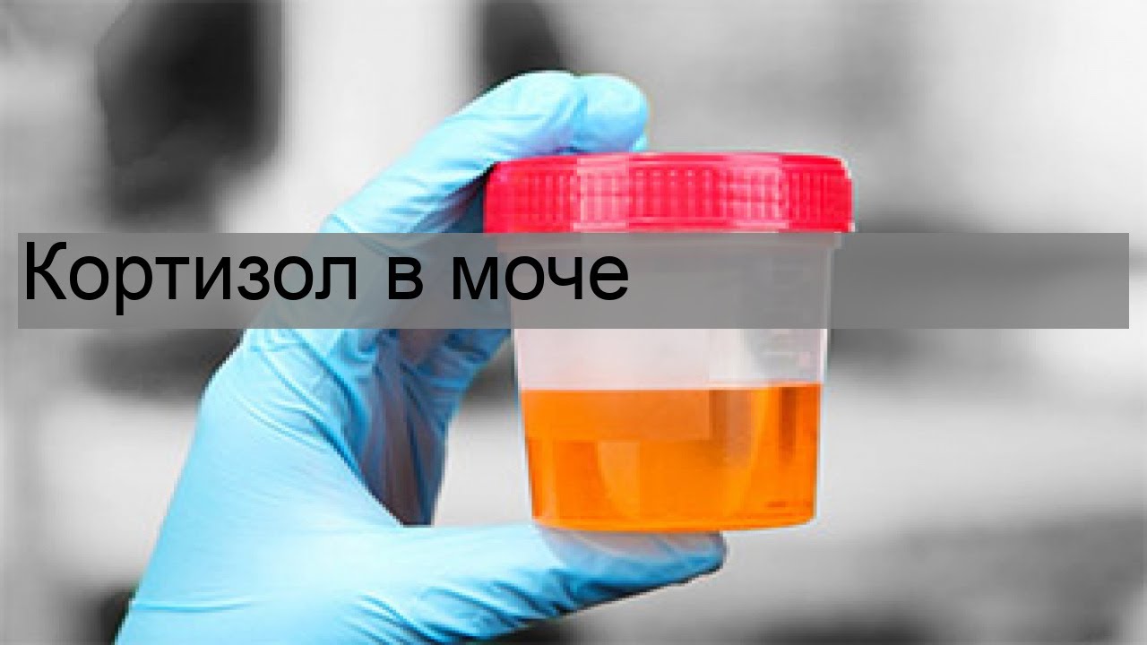Кортизол в моче