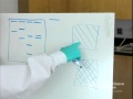 DNA Banding Patterns and Gel Electrophoresis Techniques