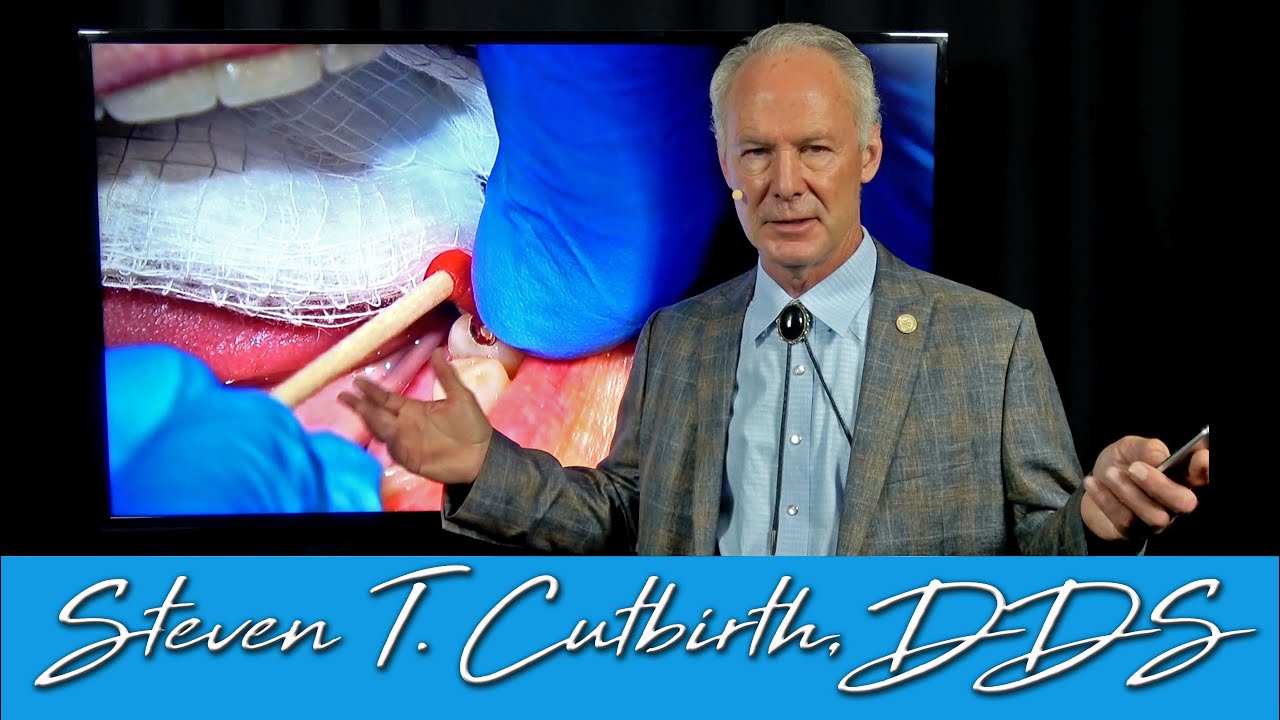 Gold Inlay on BiCuspid Dental Minute with Steven T. Cutbirth, DDS