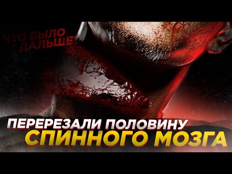 Видео: При полном пересечении спинного мозга?