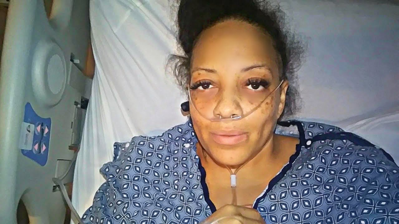 TOTAL ABDOMINAL HYSTERECTOMY POST OP SURGERY Week 1 Thru 3 VLOG What To TOTAL ABDOMINAL HYSTERECTOMY POST OP SURGERY Week 1 Thru 3 VLOG What To