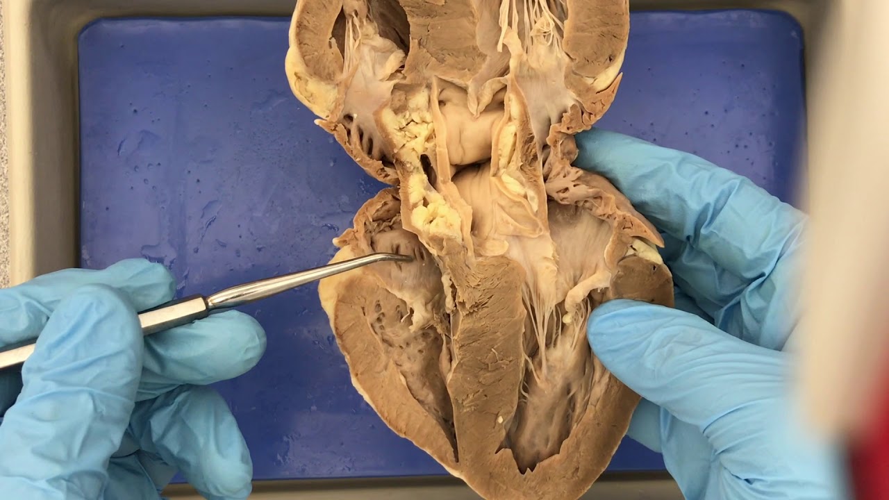 Sheep Heart and Model Anatomy Demo