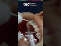 Orthodontic treatment planning: clinical phases and biomechanical control | TECH Global University