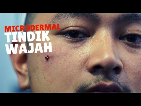 microdermal dermal piercing - tindik muka - tindik wajah - by piercing indonesia - piercing & tattoo