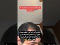 تجارب Minoxidil الجزائر تساقط الشعر الصلع عناية السعودية العراق المغرب تونس Hair 