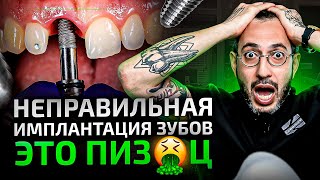 видео: П*здец на имплантации — вот к чему приводит неправильная имплантация зубов картинка: П*здец на имплантации — вот к чему приводит неправильная имплантация зубов