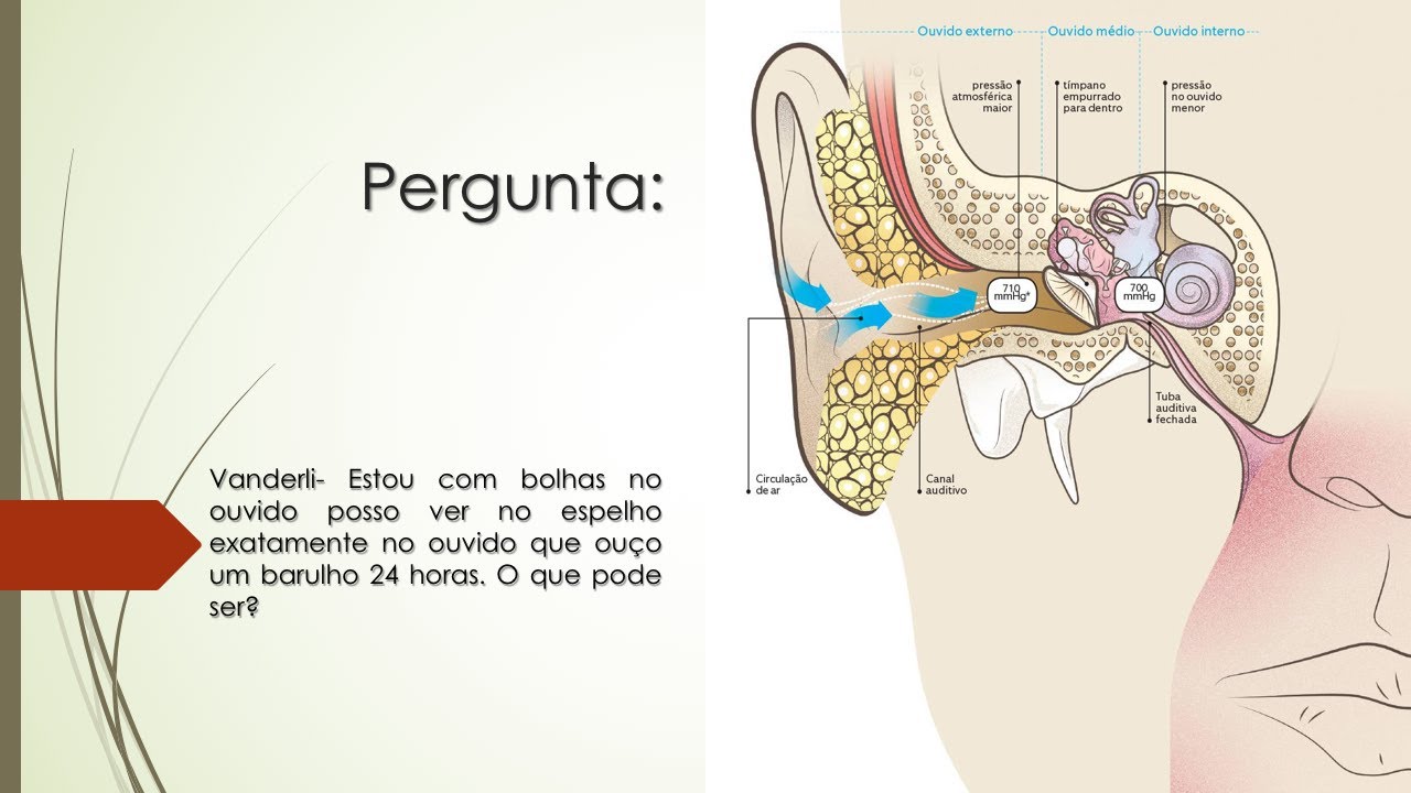 Estou com bolhas no ouvido e ouço um barulho 24h | O que pode ser ...