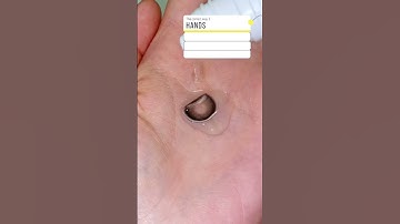 Thumbnail of Why?!#lenses #howto #colorcontacts #contactlenses #eyes #cosplay #fyp #cosplayer #makeup