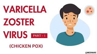 Varicella Zoster virus | Part 1 | Made very easy | Medinare