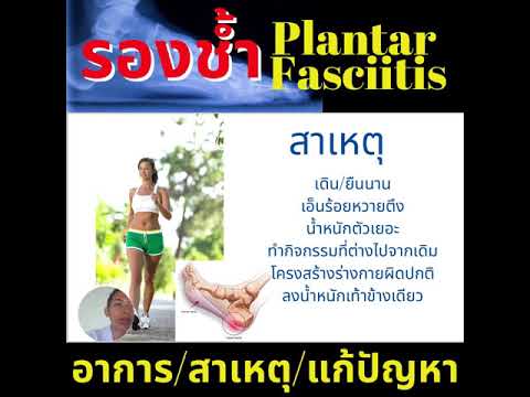 รองช้ำ plantar fasciitis สาเหตุ/อาการ/แก้ปัญหาอย่างไร