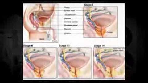 [From www.metacafe.com] 3794544.12413281.11.flv