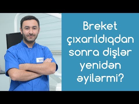 Video: Əlcəyi taxarkən çıxarmaq lazımdırmı?