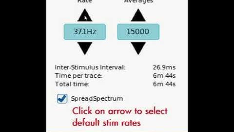 Default Stim rates TB