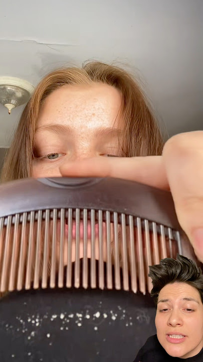 Keşfette sürekli gördüğüm kepek toplayan tarağı denedim! Dandruffbrush #tarak #kepek  işbirligi yok