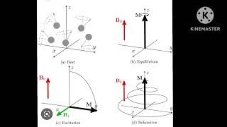 Longitudinal (T1)Relaxation in Mri.     (Spin lattice Relaxation )