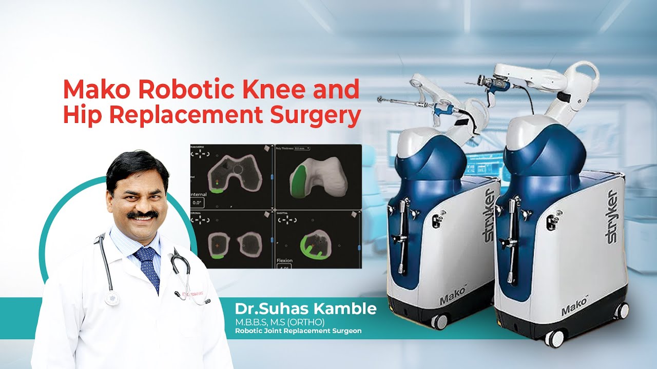 Mako Robotic Total Hip and Knee Replacement is available at Sainath ...