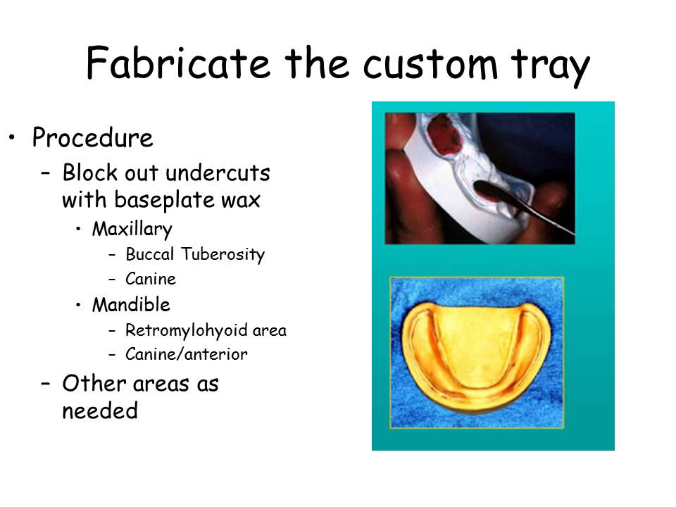 Fabricate the complete denture custom tray YouTube