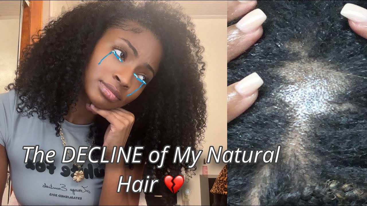 How I Got a Bald-spot + How I Grew it Back ! 