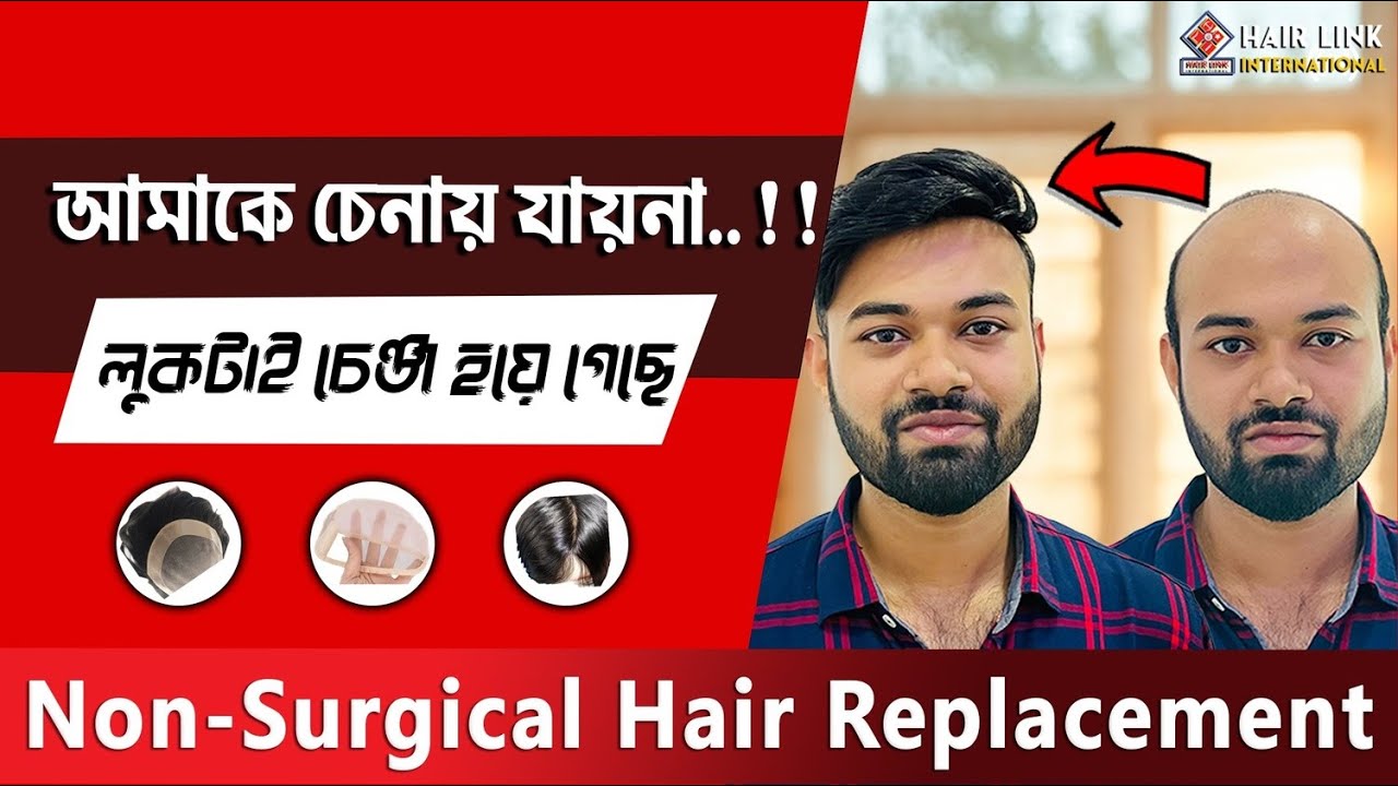 আরিফ নোয়াখালী থেকে Hair System for Men HAIR LINK INTERNATIONAL