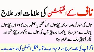 Naaf Ke Infection Ki Alamat Or Ilaj Aj Ki Achi Baatein