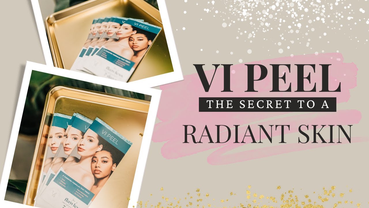 VI PEEL VLOG 3