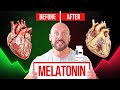 Melatonin Causing Heart Failure? The TRUTH Behind the Viral Scary Study (REAL Science Explained)