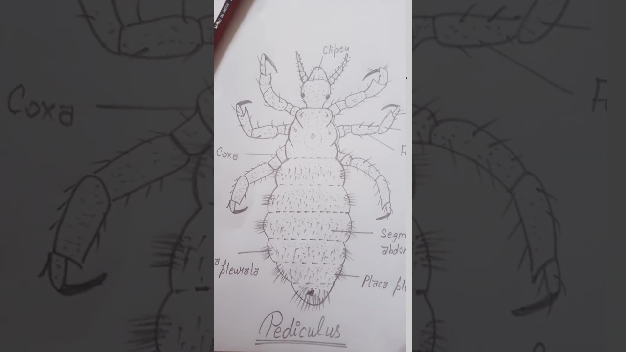 Draw the Pediculus(head lice) 