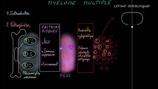 Myélome multiple  - Docteur Synapse