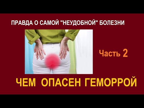 Чем опасен геморрой, полипы и рак прямой кишки