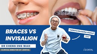 Invisalign vs Braces: Which Is Better For You? | i.Dental