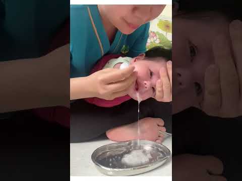 تفريغ أنف و حنجرة الرضيع ليتنفس بسهولة  