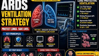 ARDS ventilation strategy