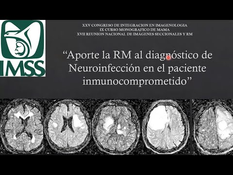 3 10 RM Al Diagnóstico De Neuroinfección En Pacientes Inmunocomprometidos Dra López 