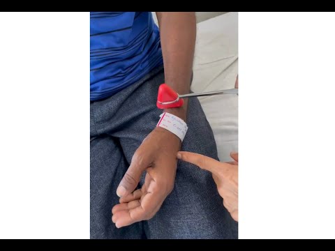 Inverted radial / brachioradialis reflex: A localizing sign; Department of Medicine; DMIHER