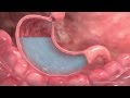 Medical animation  interior stomach