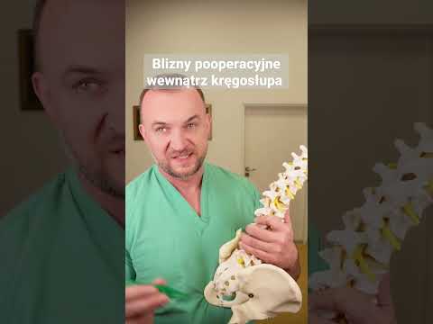 Wideo: 4 sposoby na pozbycie się Milia