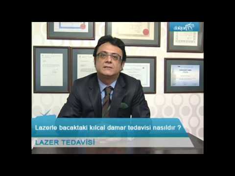 Lazer Ile Bacaktaki Kılcal Damar Tedavisi Nasıldır?