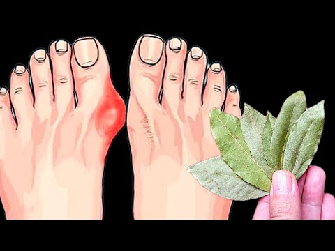 Befreien Sie sich für immer von Schmerzen und Verformungen der Finger! Das stärkste Mittel!