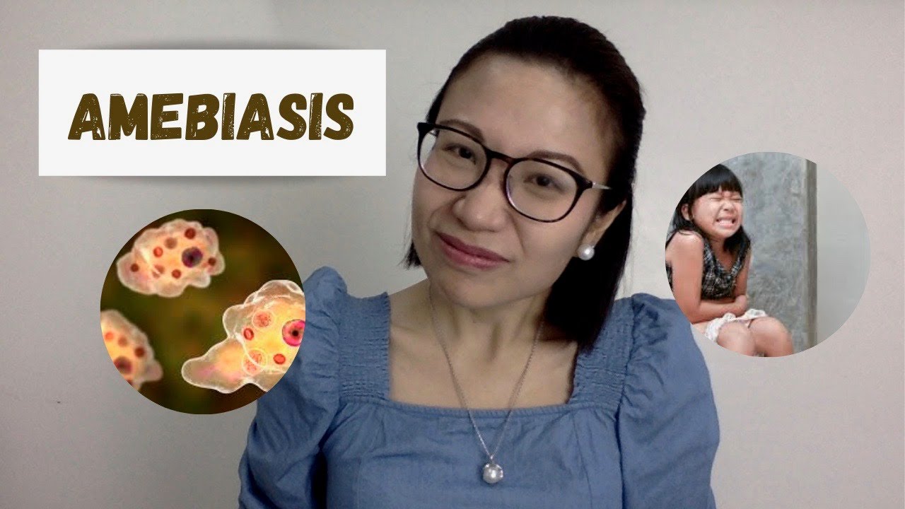 Амебиаз: паразитарная инфекция, вызывающая диарею у детей | Доктор Кристин Альба Киат