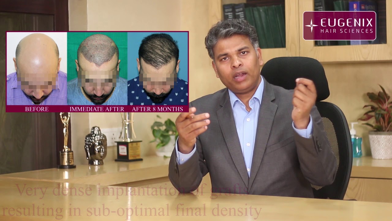 Best Hair Transplant in Mumbai Expert Surgeon  Best Cost