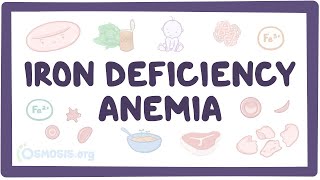 Iron deficiency anemia - an Osmosis Preview