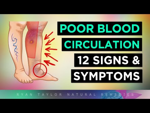 12 Signs You Have POOR Blood Flow (Circulation)