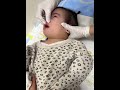 Runny nose suction【short】